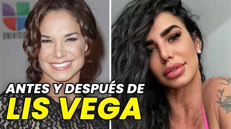 lis vega antes y después|Lis Vega: Antes y Después, 16 Fotos de su Evolución en la Pantalla